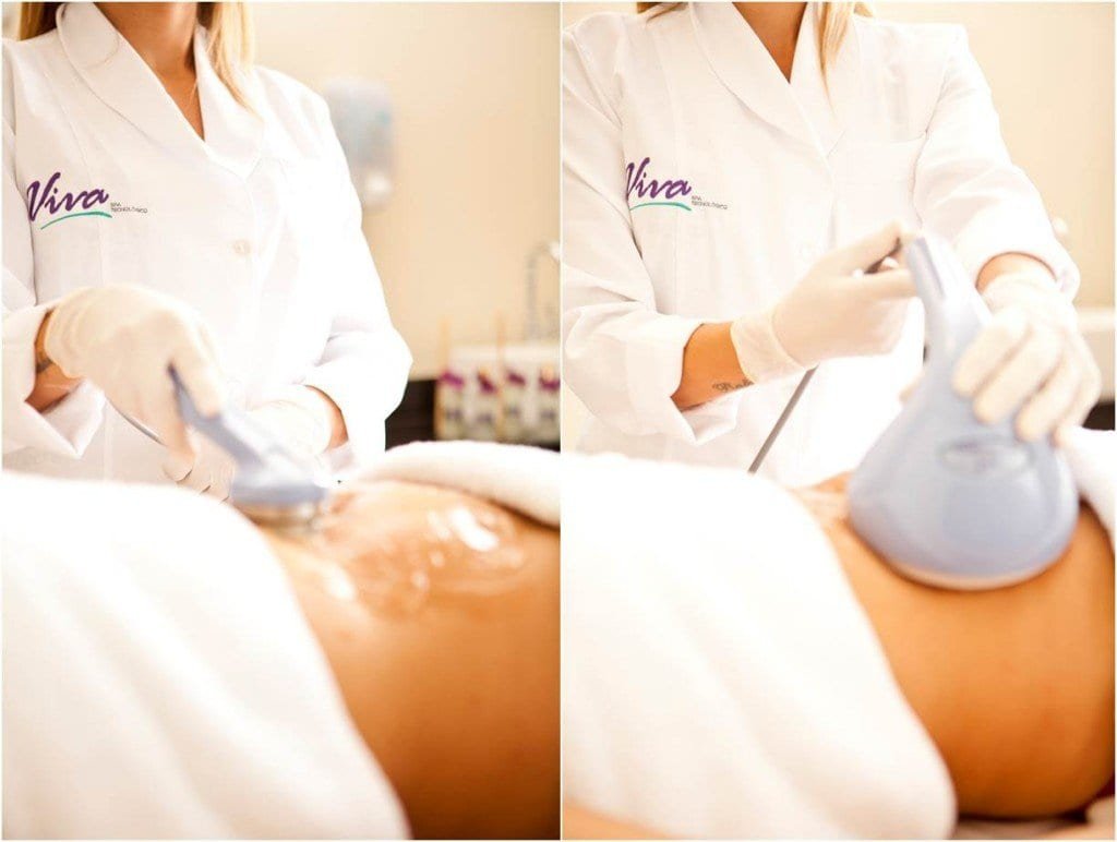 Lipocavitacao-teste