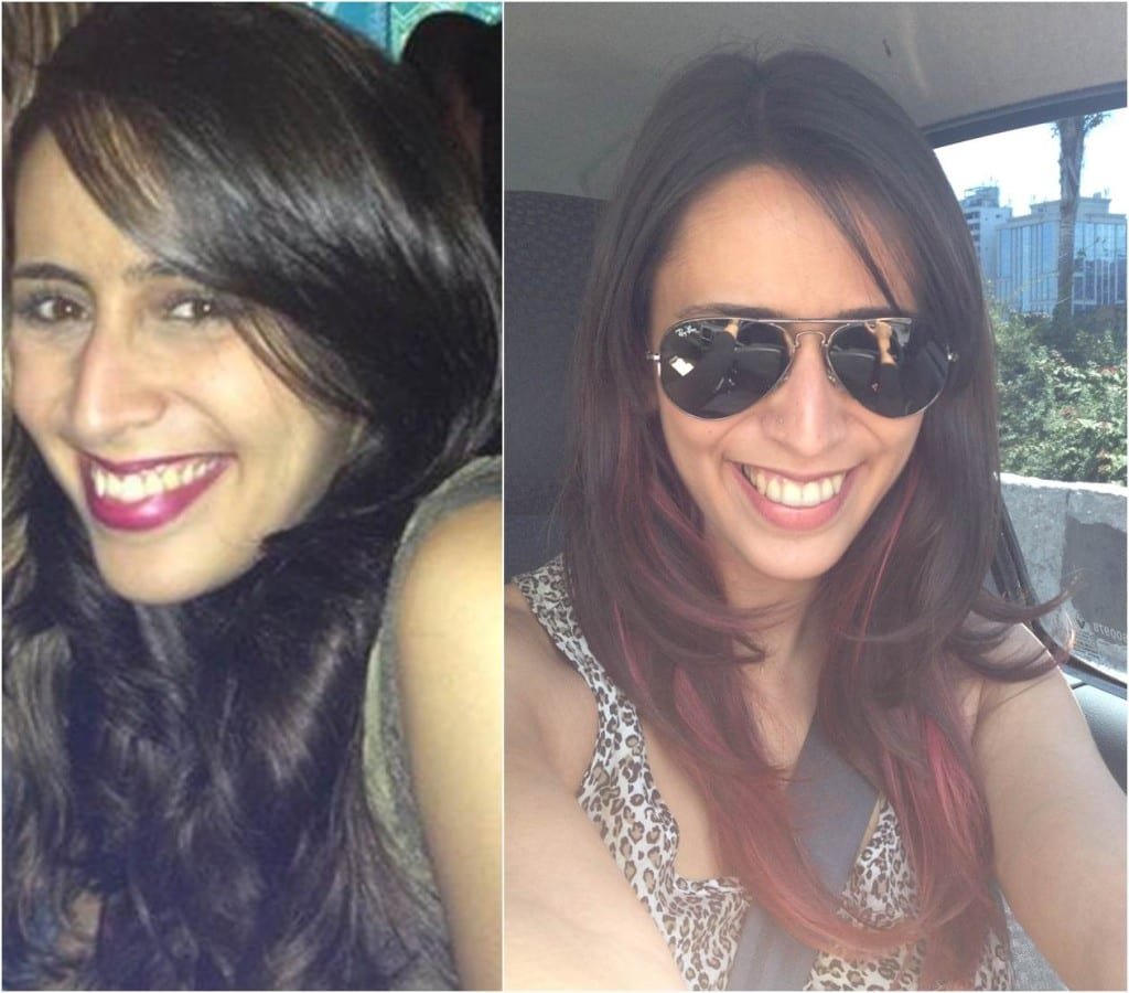 À esquerda, o antes (os dentes debaixo eram bem tortos, mas não achei nenhuma foto) e à direita o depois, já com o aparelho móvel que não dá pra ver!