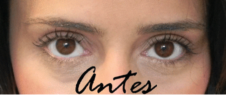 antes-depois-sobrancelha